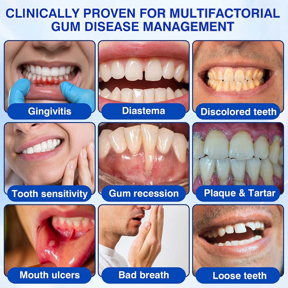 🦷UNITEM® GumRevive Periodontal Repair Gel (for bleeding gums, receding gums, and loose teeth) ✨ 🪐
