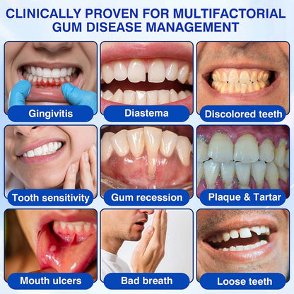 🦷UNITEM® GumRevive Periodontal Repair Gel (for bleeding gums, receding gums, and loose teeth) ✨ 🪐