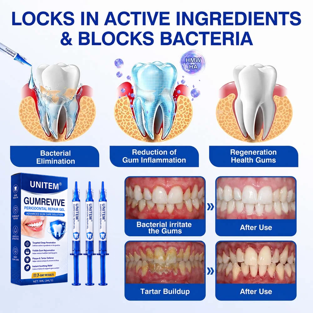 🦷UNITEM® GumRevive Periodontal Repair Gel (for bleeding gums, receding gums, and loose teeth) ✨ 🪐