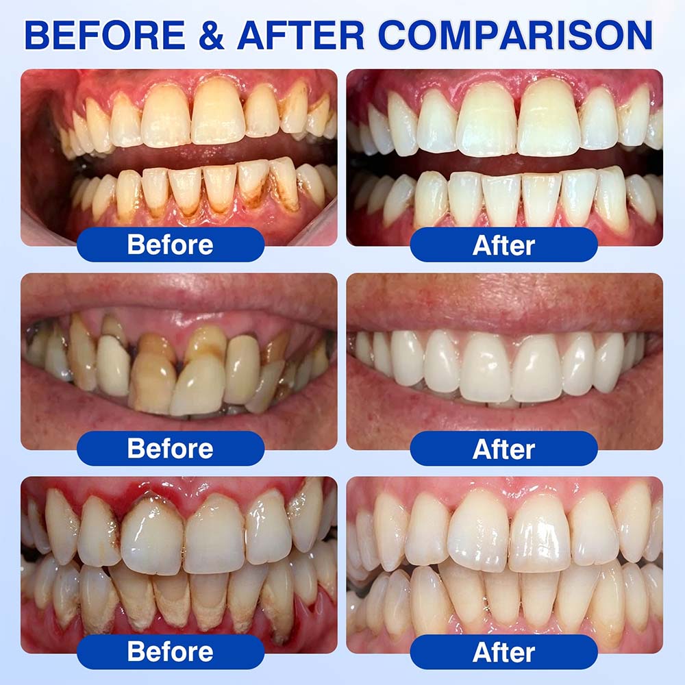 🦷UNITEM® GumRevive Periodontal Repair Gel (for bleeding gums, receding gums, and loose teeth) ✨ 🪐
